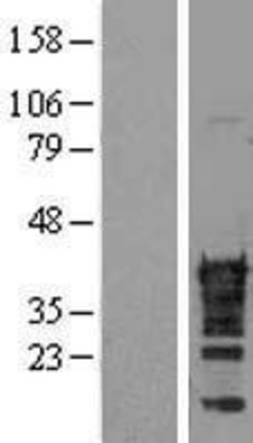 Western Blot: CDX2 Overexpression Lysate (Adult Normal) [NBL1-09065] Left-Empty vector transfected control cell lysate (HEK293 cell lysate); Right -Over-expression Lysate for CDX2.