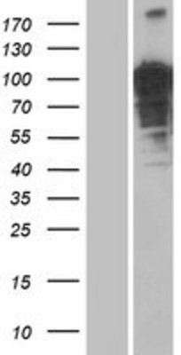 Western Blot: OTUD4 Overexpression Lysate (Adult Normal) [NBP2-04629] Left-Empty vector transfected control cell lysate (HEK293 cell lysate); Right -Over-expression Lysate for OTUD4.