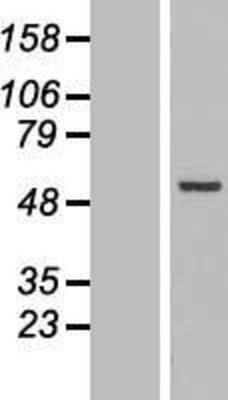 Western Blot: Cytokeratin 18 Overexpression Lysate (Adult Normal) [NBL1-12386] Left-Empty vector transfected control cell lysate (HEK293 cell lysate); Right -Over-expression Lysate for Cytokeratin 18.