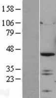 Western Blot: IRF2 Overexpression Lysate (Adult Normal) [NBL1-12031] Left-Empty vector transfected control cell lysate (HEK293 cell lysate); Right -Over-expression Lysate for IRF2.