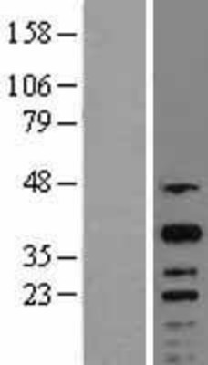 Western Blot: CREM Overexpression Lysate (Adult Normal) [NBL1-09472] Left-Empty vector transfected control cell lysate (HEK293 cell lysate); Right -Over-expression Lysate for CREM.
