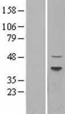 Western Blot: Dnmt2 Overexpression Lysate (Adult Normal) [NBL1-17263] Left-Empty vector transfected control cell lysate (HEK293 cell lysate); Right -Over-expression Lysate for Dnmt2.