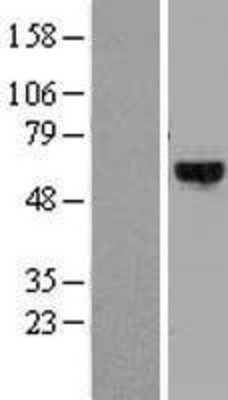 Western Blot: DYRK4 Overexpression Lysate (Adult Normal) [NBL1-10078] Left-Empty vector transfected control cell lysate (HEK293 cell lysate); Right -Over-expression Lysate for DYRK4.