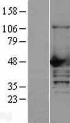 Western Blot: NCF1 Overexpression Lysate (Adult Normal) [NBL1-13509] Left-Empty vector transfected control cell lysate (HEK293 cell lysate); Right -Over-expression Lysate for NCF1.