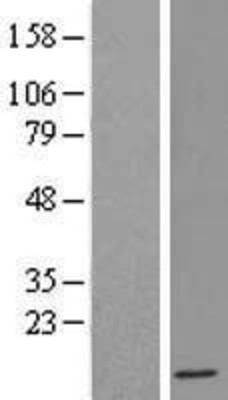 Western Blot: IFI6 Overexpression Lysate (Adult Normal) [NBL1-11832] Left-Empty vector transfected control cell lysate (HEK293 cell lysate); Right -Over-expression Lysate for IFI6.