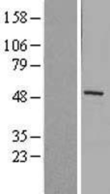 Western Blot: MMP1 Overexpression Lysate (Adult Normal) [NBL1-13149] Left-Empty vector transfected control cell lysate (HEK293 cell lysate); Right -Over-expression Lysate for MMP1.