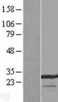 Western Blot: LXN Overexpression Lysate (Adult Normal) [NBL1-12746] Left-Empty vector transfected control cell lysate (HEK293 cell lysate); Right -Over-expression Lysate for LXN.