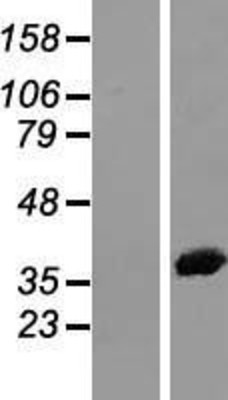 Western Blot: Annexin A2 Overexpression Lysate (Adult Normal) [NBL1-07561] Left-Empty vector transfected control cell lysate (HEK293 cell lysate); Right -Over-expression Lysate for Annexin A2.
