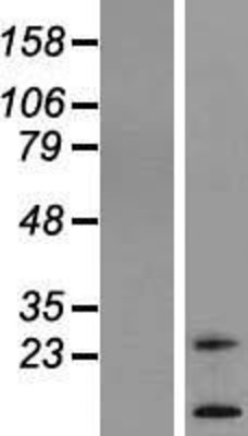 Western Blot: TM4SF20 Overexpression Lysate (Adult Normal) [NBL1-16965] Left-Empty vector transfected control cell lysate (HEK293 cell lysate); Right -Over-expression Lysate for TM4SF20.