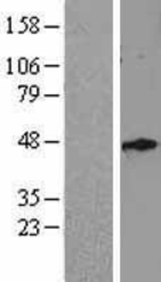 Western Blot: DIO3 Overexpression Lysate (Adult Normal) [NBP2-04196] Left-Empty vector transfected control cell lysate (HEK293 cell lysate); Right -Over-expression Lysate for DIO3.