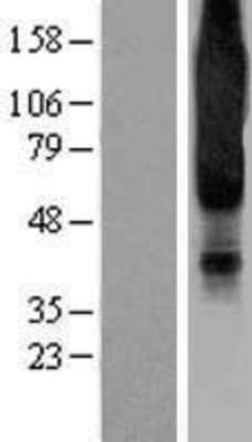 Western Blot: NPY1R Overexpression Lysate (Adult Normal) [NBP2-04180] Left-Empty vector transfected control cell lysate (HEK293 cell lysate); Right -Over-expression Lysate for NPY1R.