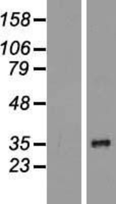 Western Blot: EEF1D Overexpression Lysate (Adult Normal) [NBP2-04462] Left-Empty vector transfected control cell lysate (HEK293 cell lysate); Right -Over-expression Lysate for EEF1D.