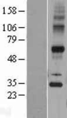 Western Blot: Synaptic glycoprotein SC2 Overexpression Lysate (Adult Normal) [NBP2-04416] Left-Empty vector transfected control cell lysate (HEK293 cell lysate); Right -Over-expression Lysate for Synaptic glycoprotein SC2.
