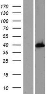 Western Blot: AS3MT Overexpression Lysate (Adult Normal) [NBP2-06623] Left-Empty vector transfected control cell lysate (HEK293 cell lysate); Right -Over-expression Lysate for AS3MT.