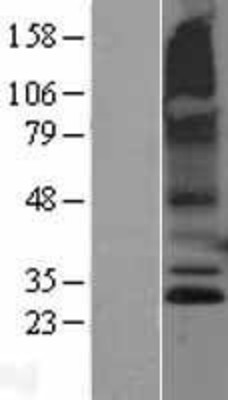 Western Blot: RNF182 Overexpression Lysate (Adult Normal) [NBL1-15438] Left-Empty vector transfected control cell lysate (HEK293 cell lysate); Right -Over-expression Lysate for RNF182.