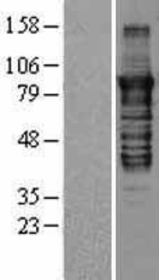 Western Blot: PKC epsilon Overexpression Lysate (Adult Normal) [NBL1-14774] Left-Empty vector transfected control cell lysate (HEK293 cell lysate); Right -Over-expression Lysate for PKC epsilon.