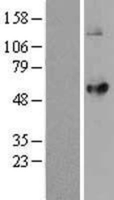 Western Blot: LPCAT2 Overexpression Lysate (Adult Normal) [NBL1-12649] Left-Empty vector transfected control cell lysate (HEK293 cell lysate); Right -Over-expression Lysate for LPCAT2.