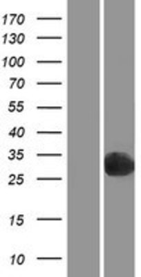 Western Blot: PGPEP1 Overexpression Lysate (Adult Normal) [NBP2-06944] Left-Empty vector transfected control cell lysate (HEK293 cell lysate); Right -Over-expression Lysate for PGPEP1.