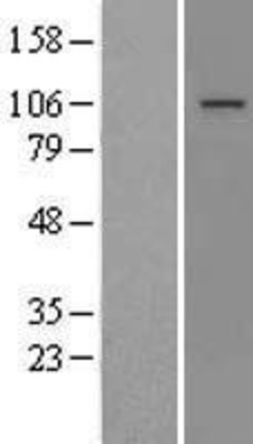 Western Blot: MTTP Overexpression Lysate (Adult Normal) [NBL1-13387] Left-Empty vector transfected control cell lysate (HEK293 cell lysate); Right -Over-expression Lysate for MTTP.
