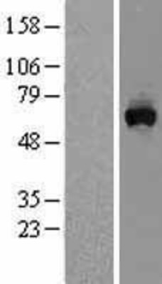 Western Blot: MON1A Overexpression Lysate (Adult Normal) [NBL1-13179] Left-Empty vector transfected control cell lysate (HEK293 cell lysate); Right -Over-expression Lysate for MON1A.