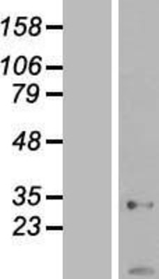Western Blot: AK2 Overexpression Lysate (Adult Normal) [NBL1-07418] Left-Empty vector transfected control cell lysate (HEK293 cell lysate); Right -Over-expression Lysate for AK2.