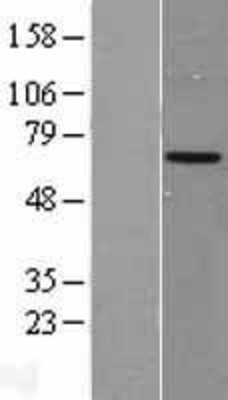Western Blot: ARSF Overexpression Lysate (Adult Normal) [NBL1-07740] Left-Empty vector transfected control cell lysate (HEK293 cell lysate); Right -Over-expression Lysate for ARSF.