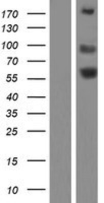 Western Blot: Angiotensin Converting Enzyme 1 Overexpression Lysate (Adult Normal) [NBL1-07237] Left-Empty vector transfected control cell lysate (HEK293 cell lysate); Right -Over-expression Lysate for Angiotensin Converting Enzyme 1.