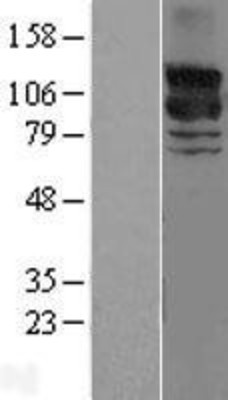 Western Blot: GRF2 Overexpression Lysate (Adult Normal) [NBL1-15151] Left-Empty vector transfected control cell lysate (HEK293 cell lysate); Right -Over-expression Lysate for GRF2.