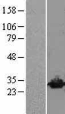 Western Blot: UCHL3 Overexpression Lysate (Adult Normal) [NBL1-17576] Left-Empty vector transfected control cell lysate (HEK293 cell lysate); Right -Over-expression Lysate for UCHL3.