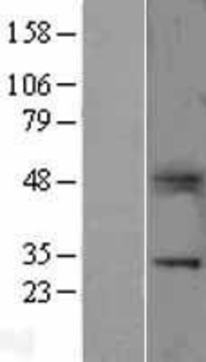 Western Blot: B7H4 Overexpression Lysate (Adult Normal) [NBL1-17768] Left-Empty vector transfected control cell lysate (HEK293 cell lysate); Right -Over-expression Lysate for B7H4.
