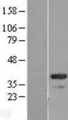 Western Blot: CABP4 Overexpression Lysate (Adult Normal) [NBL1-08624] Left-Empty vector transfected control cell lysate (HEK293 cell lysate); Right -Over-expression Lysate for CABP4.