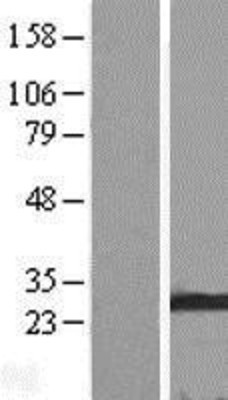 Western Blot: Membrin Overexpression Lysate (Adult Normal) [NBL1-11205] Left-Empty vector transfected control cell lysate (HEK293 cell lysate); Right -Over-expression Lysate for Membrin.