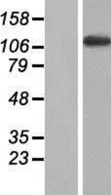 Western Blot: MYBPC2 Overexpression Lysate (Adult Normal) [NBP2-07862] Left-Empty vector transfected control cell lysate (HEK293 cell lysate); Right -Over-expression Lysate for MYBPC2.