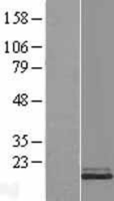 Western Blot: Stathmin 1 Overexpression Lysate (Adult Normal) [NBL1-16557] Left-Empty vector transfected control cell lysate (HEK293 cell lysate); Right -Over-expression Lysate for Stathmin 1.