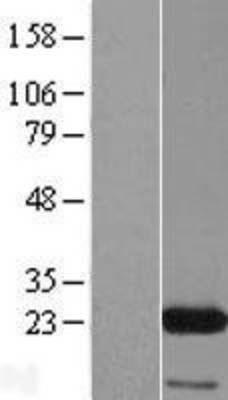 Western Blot: eIF3K Overexpression Lysate (Adult Normal) [NBP2-07433] Left-Empty vector transfected control cell lysate (HEK293 cell lysate); Right -Over-expression Lysate for eIF3K.