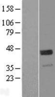 Western Blot: WIF1 Overexpression Lysate (Adult Normal) [NBL1-17851] Left-Empty vector transfected control cell lysate (HEK293 cell lysate); Right -Over-expression Lysate for WIF1.
