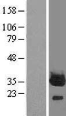Western Blot: PROSC Overexpression Lysate (Adult Normal) [NBL1-14813] Left-Empty vector transfected control cell lysate (HEK293 cell lysate); Right -Over-expression Lysate for PROSC.