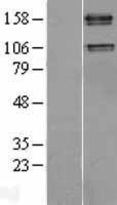 Western Blot: IGF1 Receptor Overexpression Lysate (Adult Normal) [NBL1-11867] Left-Empty vector transfected control cell lysate (HEK293 cell lysate); Right -Over-expression Lysate for IGF1 Receptor.