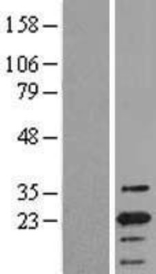 Western Blot: ASC/TMS1 Overexpression Lysate (Adult Normal) [NBL1-15016] Left-Empty vector transfected control cell lysate (HEK293 cell lysate); Right -Over-expression Lysate for ASC/TMS1.