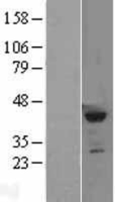 Western Blot: SETD8 Overexpression Lysate (Adult Normal) [NBL1-15870] Left-Empty vector transfected control cell lysate (HEK293 cell lysate); Right -Over-expression Lysate for SETD8.
