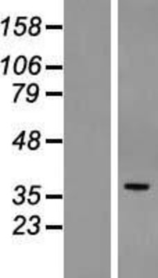 Western Blot: POPDC3 Overexpression Lysate (Adult Normal) [NBL1-14610] Left-Empty vector transfected control cell lysate (HEK293 cell lysate); Right -Over-expression Lysate for POPDC3.