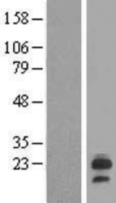 Western Blot: LHFP Overexpression Lysate (Adult Normal) [NBL1-12511] Left-Empty vector transfected control cell lysate (HEK293 cell lysate); Right -Over-expression Lysate for LHFP.