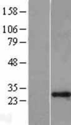 Western Blot: GAS41 Overexpression Lysate (Adult Normal) [NBL1-17927] Left-Empty vector transfected control cell lysate (HEK293 cell lysate); Right -Over-expression Lysate for GAS41.