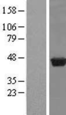 Western Blot: PUS1 Overexpression Lysate (Adult Normal) [NBL1-14997] Left-Empty vector transfected control cell lysate (HEK293 cell lysate); Right -Over-expression Lysate for PUS1.