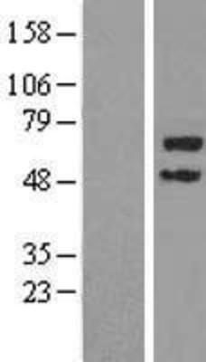 Western Blot: TRIM45 Overexpression Lysate (Adult Normal) [NBL1-17300] Left-Empty vector transfected control cell lysate (HEK293 cell lysate); Right -Over-expression Lysate for TRIM45.