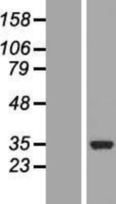 Western Blot: COQ3 Overexpression Lysate (Adult Normal) [NBL1-09390] Left-Empty vector transfected control cell lysate (HEK293 cell lysate); Right -Over-expression Lysate for COQ3.