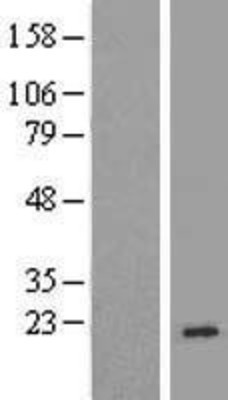Western Blot: TNP2 Overexpression Lysate (Adult Normal) [NBP2-07755] Left-Empty vector transfected control cell lysate (HEK293 cell lysate); Right -Over-expression Lysate for TNP2.