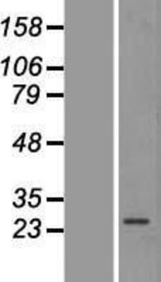 Western Blot: PRKAB2 Overexpression Lysate (Adult Normal) [NBP2-07757] Left-Empty vector transfected control cell lysate (HEK293 cell lysate); Right -Over-expression Lysate for PRKAB2.