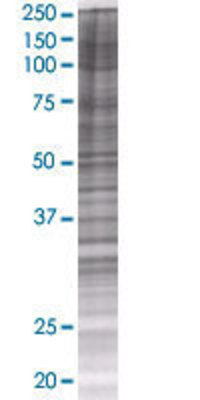 METTL2B transfected lysate.