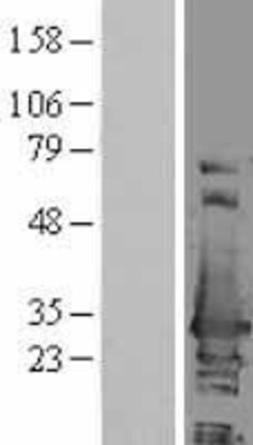 Western Blot: ERAB Overexpression Lysate (Adult Normal) [NBL1-11722] Left-Empty vector transfected control cell lysate (HEK293 cell lysate); Right -Over-expression Lysate for ERAB.